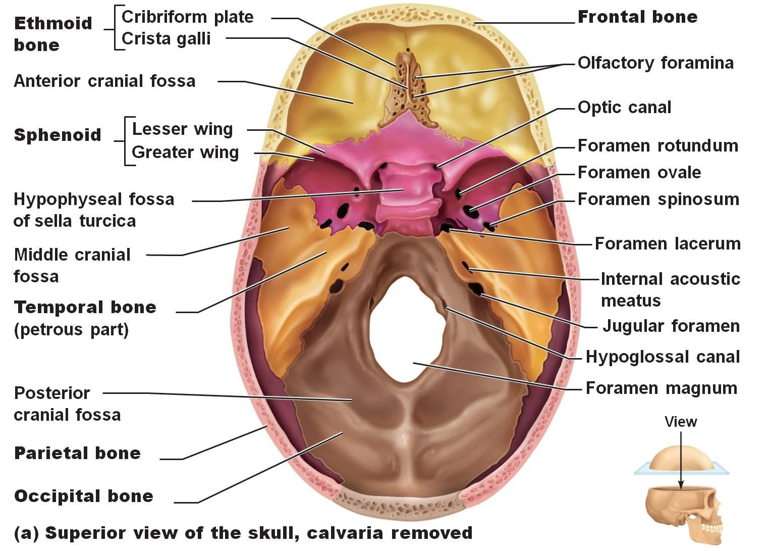Anterior Cranial Fossa | RANZCRPart1 Wiki | FANDOM powered by Wikia