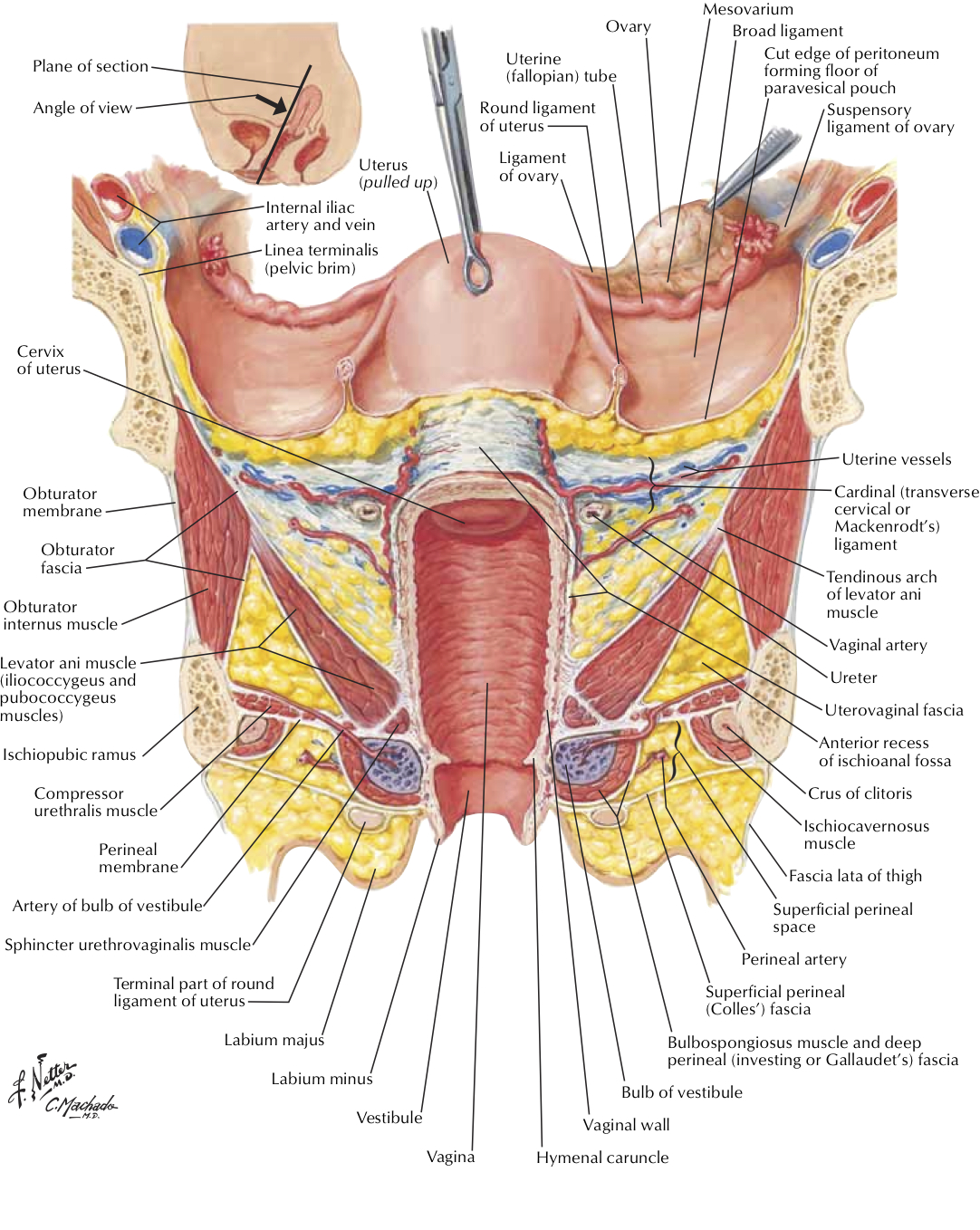 Viscera:Uterus | RANZCRPart1 Wiki | FANDOM powered by Wikia