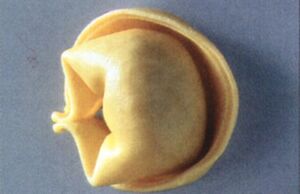 Tortelloni