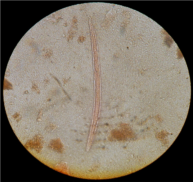Strongyloides stercoralis | Wiki Reino Animalia | Fandom