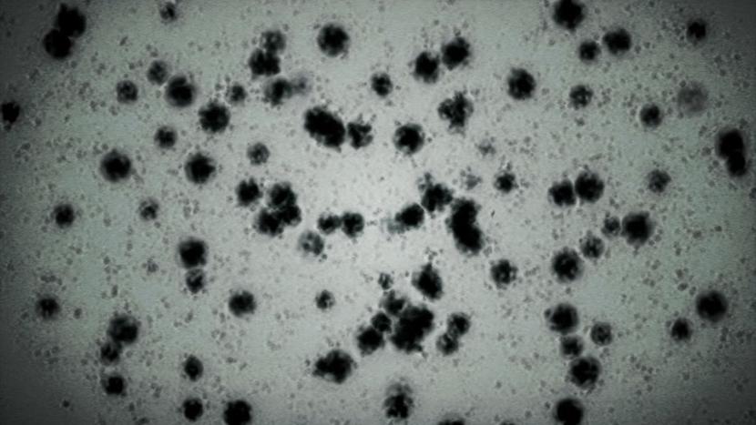 Épidémie/pandémie de Coronavirus/Covid 19 (1) - Page 12 Latest?cb=20120417145719&path-prefix=de