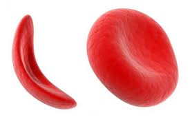 Red-Blood-Cell-Anemia-01-goog