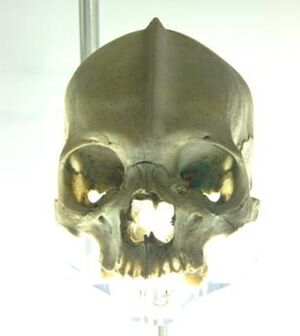 SCP-139