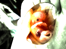 Thumb-fetus