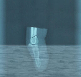 Xray
