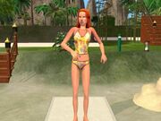 Sunburn