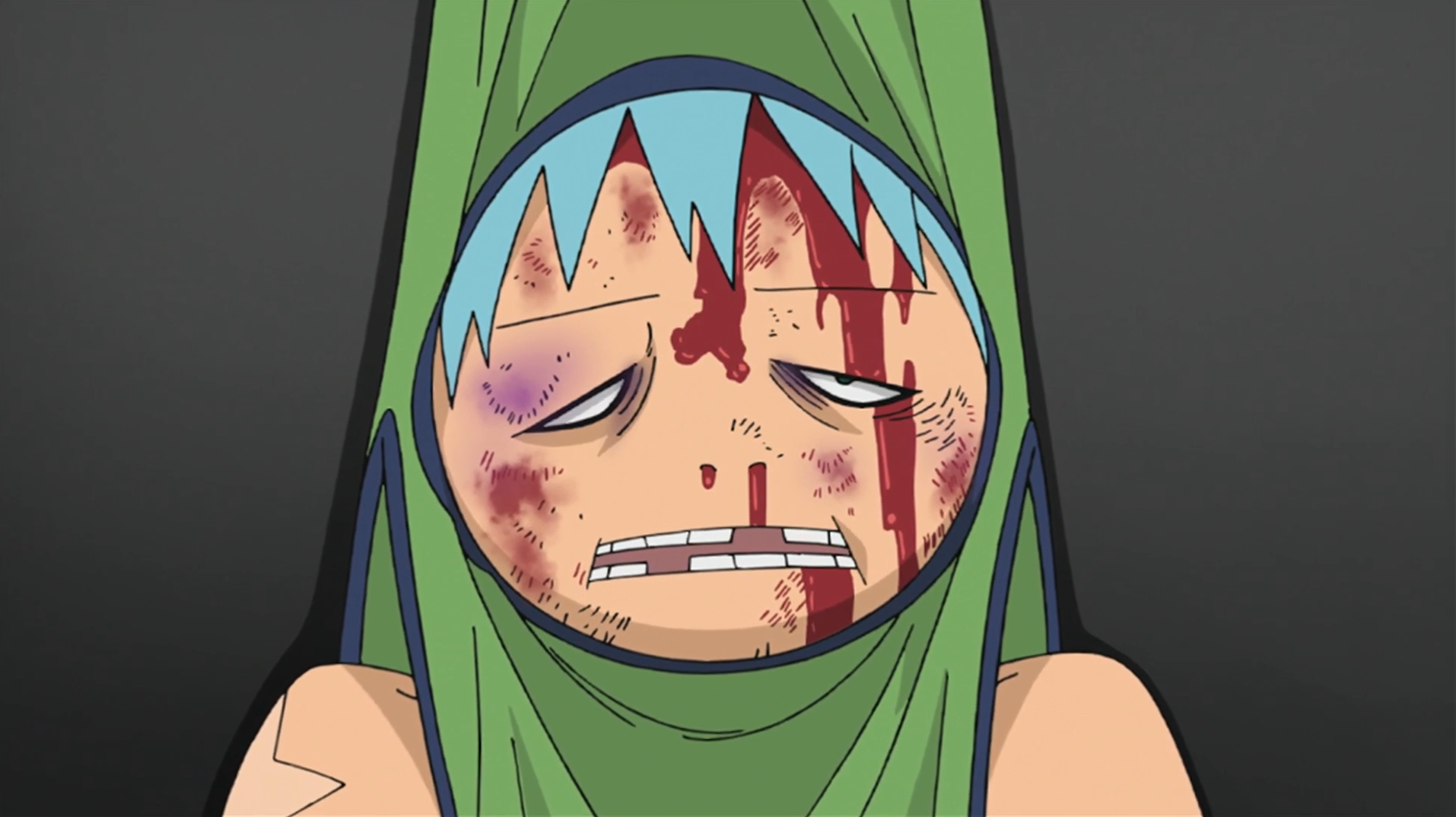 Image - Soul Eater Episode 14 - Black Star is injured.png | Soul Eater