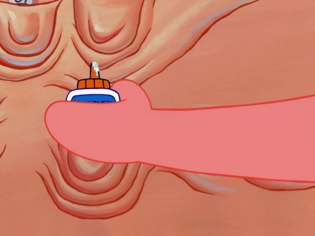 File:Stuck in the Wringer 038.png