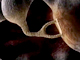 Eardrum