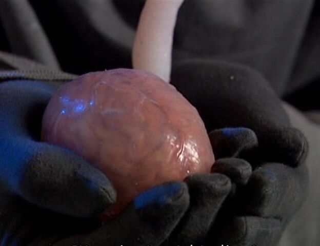 File:Ood hindbrain.jpg