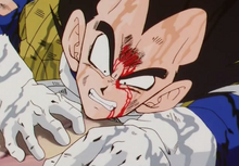 Vegeta after being defeated by Zarbon