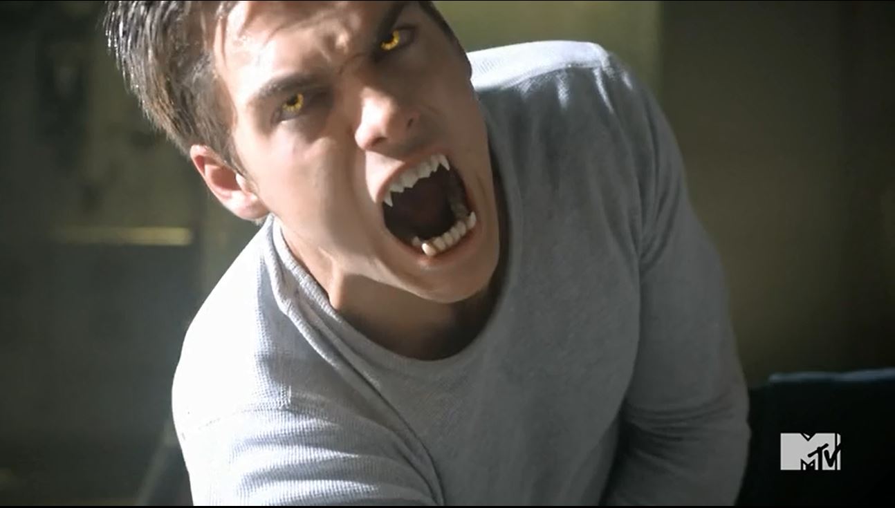 The Good Doctor Season 5 Episode 8 Image - Teen Wolf Season 5 Episode 8 Ouroboros liam Tells the dread