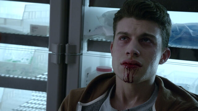 File:Andrew-Matarazzo-Gabe-dying-Teen-Wolf-Season-6-Episode-20-The-Wolves-of-War.jpg