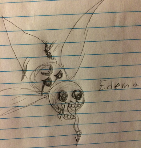File:Edema concept.png
