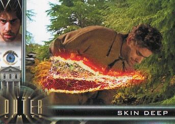 Skin deep 3
