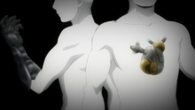 Cyborg Heart and Arm (Anime)