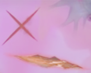 180px-Lacerations