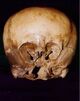 Starchild skull 1