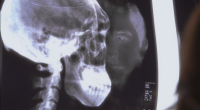 Underneathxray