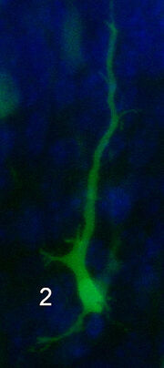 GFP neuron