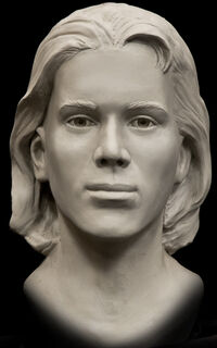 Shafter Jane Facial Reconstruction