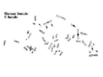C-banding