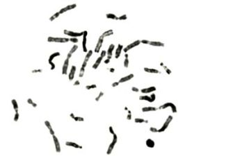 BrDu banding