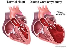 Cardiac-Arrhythmias