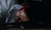 Sacks Dead