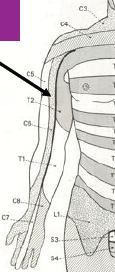 Dermatome