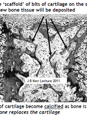 Bone scaffold