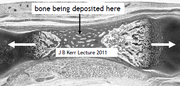 Developing bone