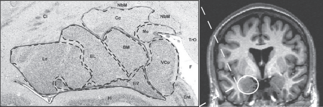Amygdala nuclei