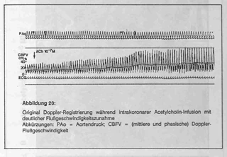 Wiki vroniplag Wiki vroniplag