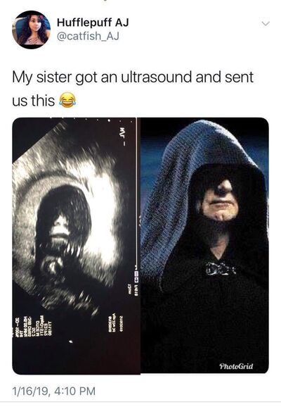 Ultrasound going as foreseen