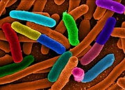 TestEcoli TestEcoli