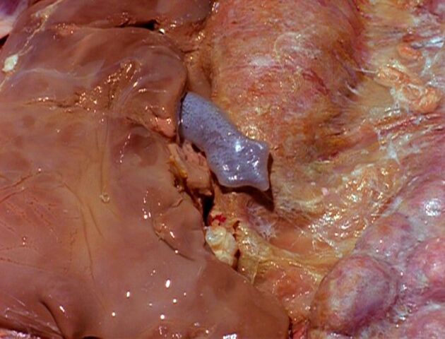 File:Flatworm in internal organs.jpg