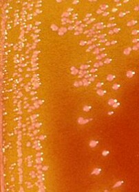 Serratia marcescens 01